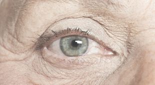 Trockene Augen